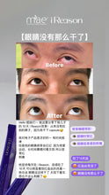 Load image into Gallery viewer, Ireason 護眼神器
