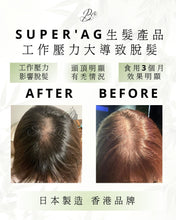 將圖片載入圖庫檢視器 SUPER‘AG 生髮產品