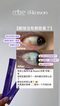 Load image into Gallery viewer, Ireason 護眼神器