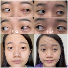 Load image into Gallery viewer, Ireason 護眼神器